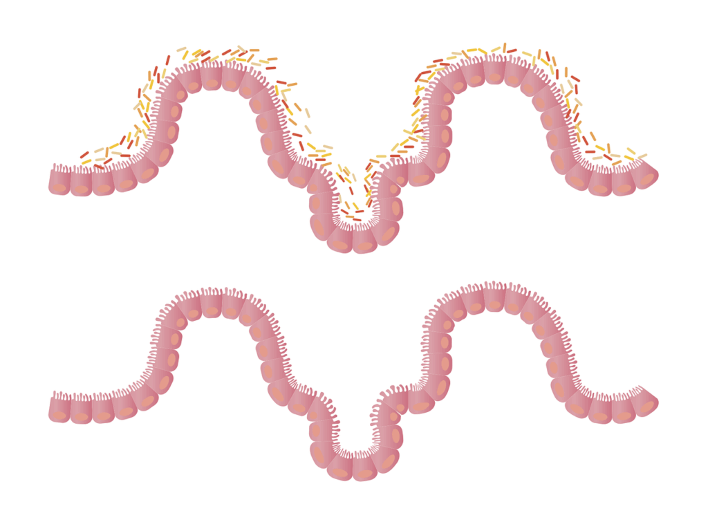 intestino e disbiosi